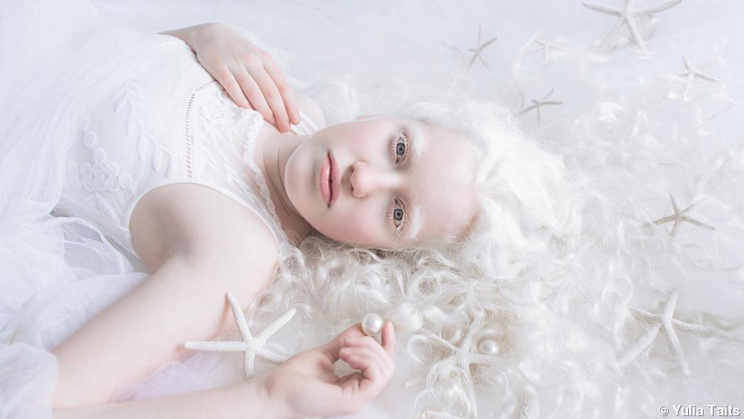 Portrait series conveys the beauty of albinism Portrait series conveys the beauty of albinism